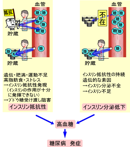 ｲﾝｽﾘﾝ抵抗性・分泌不全