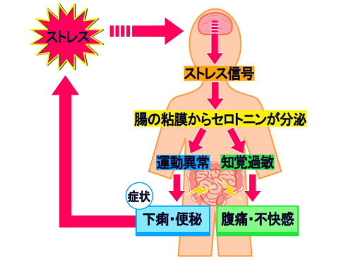 過敏性腸症候群のメカニズム