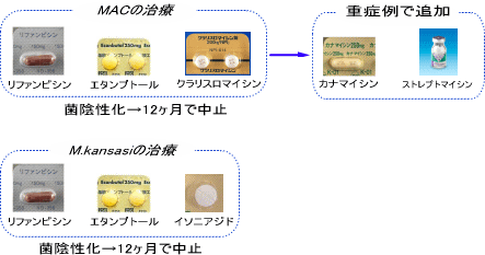 非結核性好酸菌症の治療